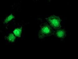 SNTA1 Monoclonal Antibody (OTI2D5), TrueMAB , OriGene 100 &mu;L; Unconjugated:Antibodies,