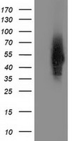 SNTA1 Monoclonal Antibody (OTI2B9), TrueMAB , OriGene 30 μL; Unconjugated:Antibodies,