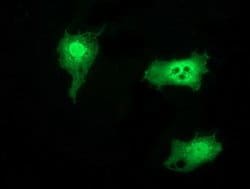 SNTG1 Monoclonal Antibody (OTI3G10), TrueMAB , OriGene 30 &mu;L; Unconjugated:Antibodies,