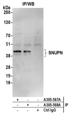 SNUPN Rabbit anti-Human, Polyclonal, Bethyl Laboratories 100 &mu;L; Unconjugated:Antibodies,