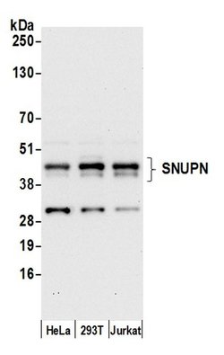 SNUPN Polyclonal Antibody, Bethyl Laboratories 20 &mu;L; Unconjugated:Antibodies,
