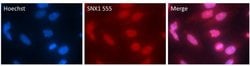 Invitrogen SNX1 Polyclonal Antibody, Alexa Fluor 555 50 &mu;g; Alexa Fluor