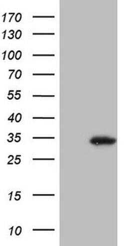 SNX10 Monoclonal Antibody (OTI3F1), TrueMAB , OriGene:Antibodies:Primary