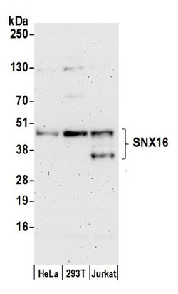 SNX16 Polyclonal Antibody, Bethyl Laboratories 20 &mu;L; Unconjugated:Antibodies,