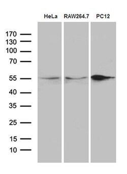 SNX4 Monoclonal Antibody (OTI1B1), TrueMAB , OriGene 100 &mu;L; Unconjugated:Antibodies,