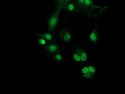 SNX8 Mouse anti-Human, Clone: OTI1E5, lyophilized, TrueMAB 100 &mu;g; Unconjugated:Antibodies,