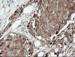 SNX8 Monoclonal Antibody (OTI1A1), TrueMAB , OriGene 100 &mu;L; Unconjugated:Antibodies,