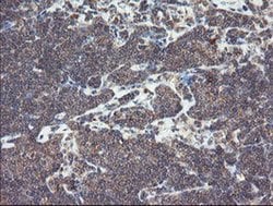 SNX8 Monoclonal Antibody (OTI1A1), TrueMAB , OriGene 100 &mu;L; Unconjugated:Antibodies,