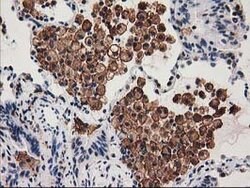 SNX8 Mouse anti-Human, Clone: OTI1E5, lyophilized, TrueMAB 100 &mu;g; Unconjugated:Antibodies,
