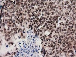 SNX8 Monoclonal Antibody (OTI1E5), TrueMAB , OriGene 30 &mu;L; Unconjugated:Antibodies,