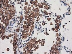 SNX8 Monoclonal Antibody (OTI4F8), TrueMAB , OriGene 30 &mu;L; Unconjugated:Antibodies,