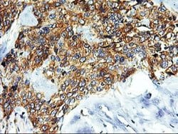 SNX8 Monoclonal Antibody (OTI3C4), TrueMAB , OriGene 100 &mu;L; Unconjugated:Antibodies,