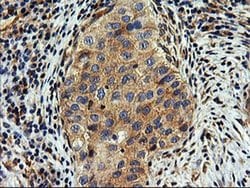 SNX8 Monoclonal Antibody (OTI3C4), TrueMAB , OriGene 100 &mu;L; Unconjugated:Antibodies,