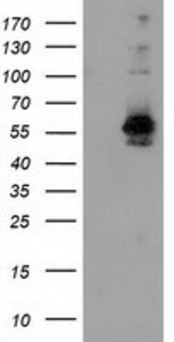 SNX8 Mouse anti-Human, Clone: OTI1E5, lyophilized, TrueMAB 100 &mu;g; Unconjugated:Antibodies,