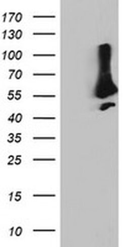 SNX8 Monoclonal Antibody (OTI3C4), TrueMAB , OriGene 100 &mu;L; Unconjugated:Antibodies,