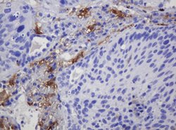 SOAT2 Monoclonal Antibody (OTI2E12), TrueMAB , OriGene:Antibodies:Primary