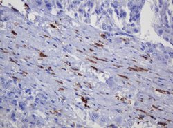 SOAT2 Monoclonal Antibody (OTI2E12), TrueMAB , OriGene:Antibodies:Primary
