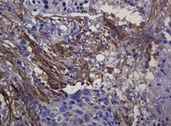 SOAT2 Mouse anti-Human, Clone: OTI2D3, liquid, TrueMAB 100 &mu;L; Unconjugated:Antibodies,