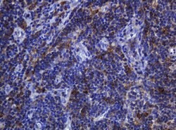 SOAT2 Mouse anti-Human, Clone: OTI2D3, lyophilized, TrueMAB 100 &mu;g;