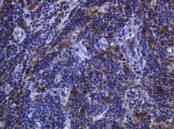 SOAT2 Mouse anti-Human, Clone: OTI2D3, liquid, TrueMAB 100 &mu;L; Unconjugated:Antibodies,