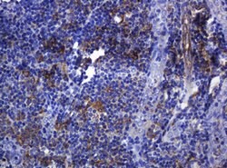SOAT2 Mouse anti-Human, Clone: OTI2D3, lyophilized, TrueMAB 100 &mu;g;