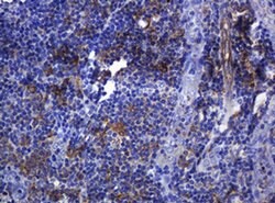SOAT2 Mouse anti-Human, Clone: OTI2D3, liquid, TrueMAB 100 &mu;L; Unconjugated:Antibodies,