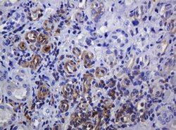 SOAT2 Mouse anti-Human, Clone: OTI2D3, liquid, TrueMAB 100 &mu;L; Unconjugated:Antibodies,