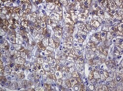 SOAT2 Mouse anti-Human, Clone: OTI2D3, lyophilized, TrueMAB 100 &mu;g;
