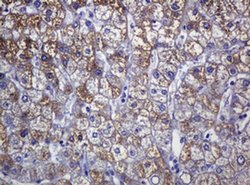 SOAT2 Mouse anti-Human, Clone: OTI2D3, liquid, TrueMAB 100 &mu;L; Unconjugated:Antibodies,