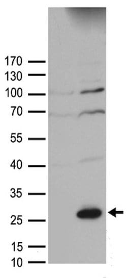 SOCS1 Rabbit anti-Human, Mouse, Rat, Polyclonal, liquid, OriGene 100 &mu;L;