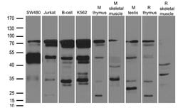 SOCS1 Rabbit anti-Human, Mouse, Rat, Polyclonal, liquid, OriGene 100 &mu;L;