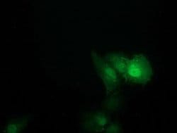SOCS3 Monoclonal Antibody (OTI6C12), TrueMAB , OriGene 100 &mu;L; Unconjugated:Antibodies,