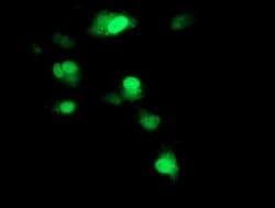 SOCS3 Monoclonal Antibody (OTI5C2), TrueMAB , OriGene:Antibodies:Primary