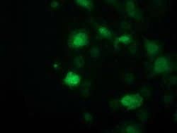 SOCS3 Monoclonal Antibody (OTI3B8), TrueMAB , OriGene:Antibodies:Primary