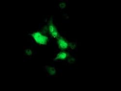 SOCS3 Monoclonal Antibody (OTI7E10), TrueMAB , OriGene 100 &mu;L; Unconjugated:Antibodies,