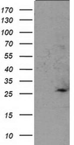SOCS3 Monoclonal Antibody (OTI6F3), TrueMAB , OriGene 100 &mu;L; Unconjugated:Antibodies,