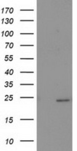 SOCS3 Mouse anti-Human, Clone: OTI6C12, lyophilized, TrueMAB 100 &mu;g;
