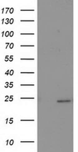 SOCS3 Monoclonal Antibody (OTI6C12), TrueMAB , OriGene 100 &mu;L; Unconjugated:Antibodies,
