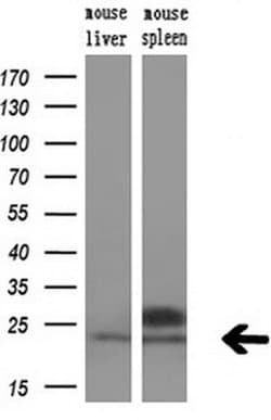 SOCS3 Monoclonal Antibody (OTI5C2), TrueMAB , OriGene:Antibodies:Primary
