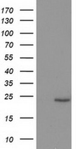 SOCS3 Monoclonal Antibody (OTI3B8), TrueMAB , OriGene 100 &mu;L; Unconjugated:Antibodies,
