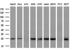 SOCS3 Monoclonal Antibody (OTI7E10), TrueMAB , OriGene:Antibodies:Primary