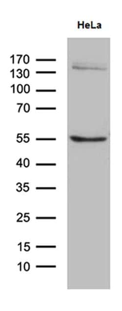 SOCS4 Monoclonal Antibody (OTI5H9), TrueMAB , OriGene:Antibodies:Primary