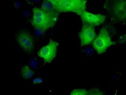 SORD Mouse anti-Human, Clone: OTI17E7, liquid, TrueMAB 100 &mu;L; Unconjugated:Antibodies,