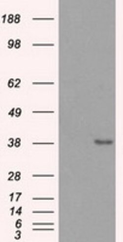 SORD Mouse anti-Human, Clone: OTI9E7, lyophilized, TrueMAB 100 &mu;g; Unconjugated:Antibodies,