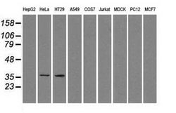 SORD Mouse anti-Human, Clone: OTI9E7, lyophilized, TrueMAB 100 &mu;g; Unconjugated:Antibodies,