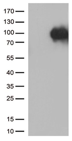 SORT1 Mouse anti-Human, Clone: OTI3H4, lyophilized, TrueMAB 100 &mu;g;