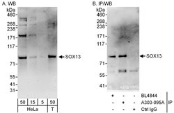 SOX13 Rabbit anti-Human, Polyclonal, Bethyl Laboratories 100 &mu;L; Unconjugated:Antibodies,