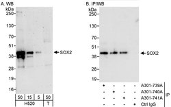 SOX2 Rabbit anti-Human, Polyclonal, Bethyl Laboratories 100 &mu;L; Unconjugated:Antibodies,