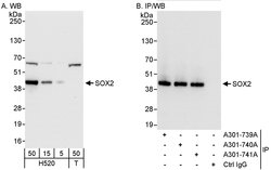 SOX2 Rabbit anti-Human, Polyclonal, Bethyl Laboratories 100 &mu;L; Unconjugated:Antibodies,