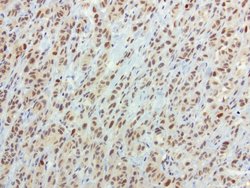SOX5 Mouse anti-Human, Clone: UMAB53, liquid, UltraMAB 100 &mu;L; Unconjugated:Antibodies,